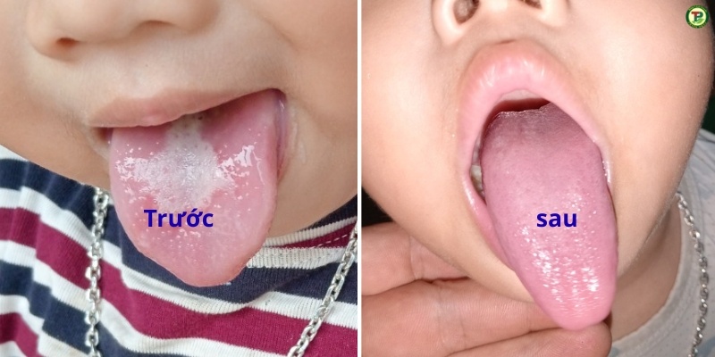 Cháu Hoàng Anh - Bình Thanh, Tp. HCM